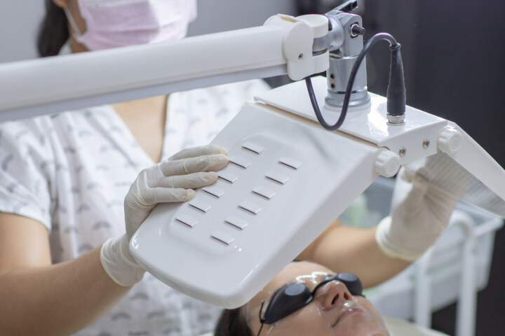 Photodynamic Therapy Treatment