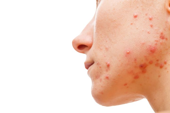 Skintechmedical com au medical and skin clinic acne treatments