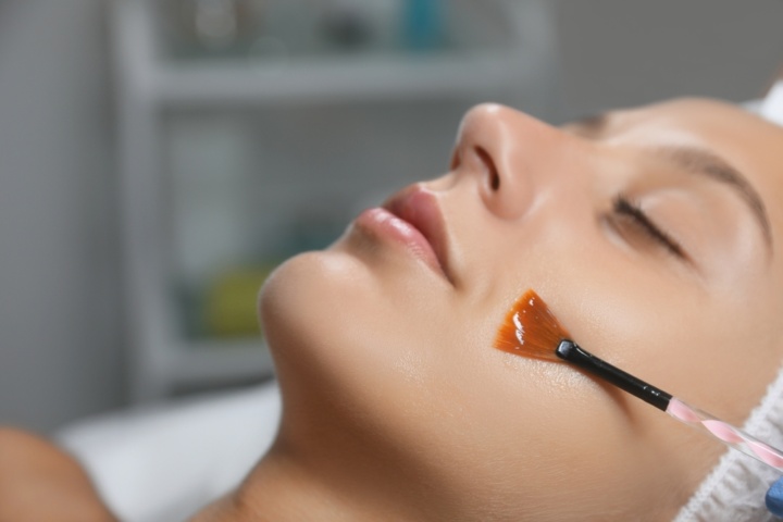 Skin peels