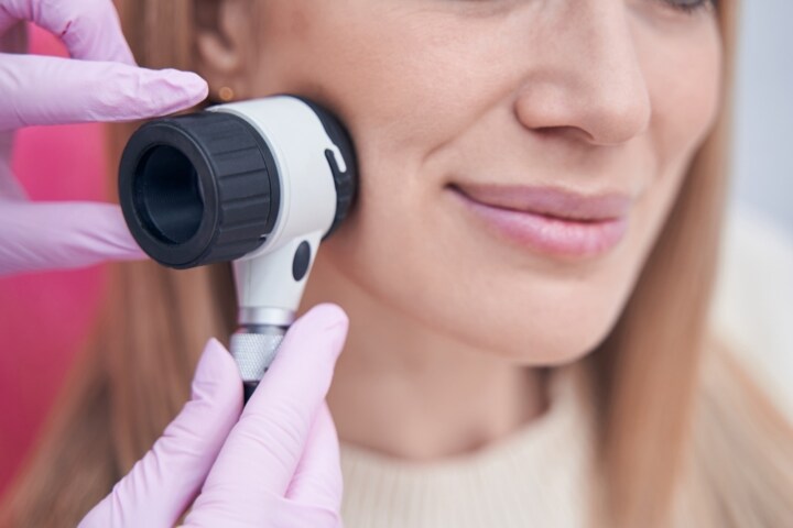 Dermoscopy Nurse Skin Screening